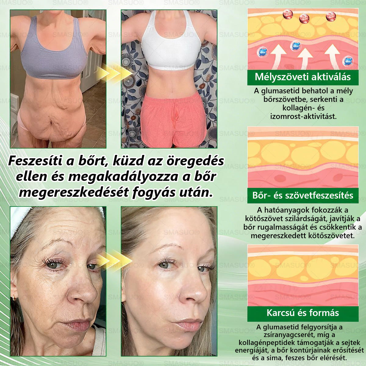 🍃Európai egészségügyi előírásoknak megfelelő · 👩‍⚕️Orvosi szakértők által ajánlott termék| 🎁 SMASUO® Glumasetide 8 az 1-ben Karcsú és Egészséges Nano Mikrotűs Tapasz