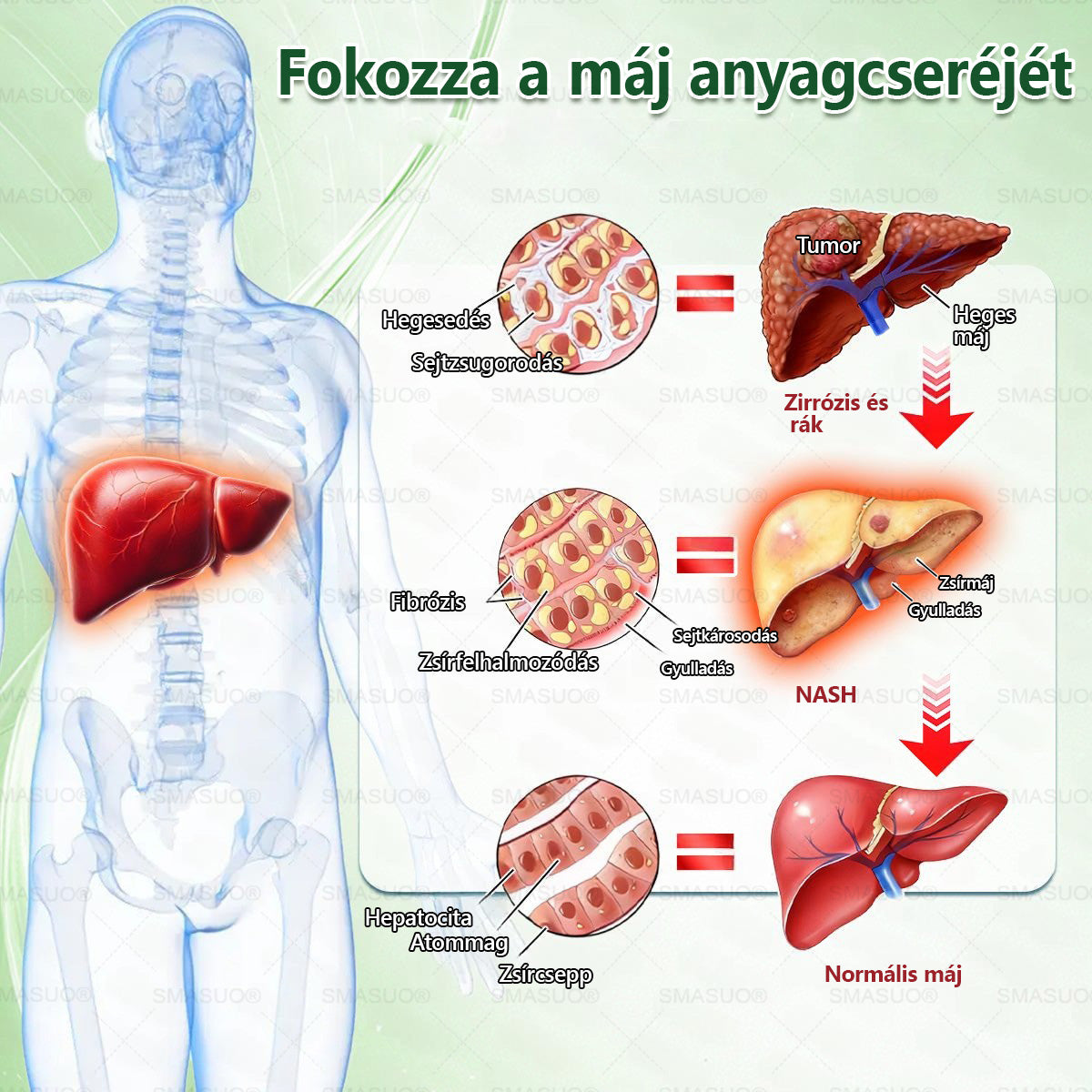 Európai egészségügyi előírásoknak megfelelő · 👩‍⚕️Orvosi szakértők által ajánlott termék| 🎁 SMASUO® Glumasetide 8 az 1-ben Karcsú és Egészséges Nano Mikrotűs Tapasz
