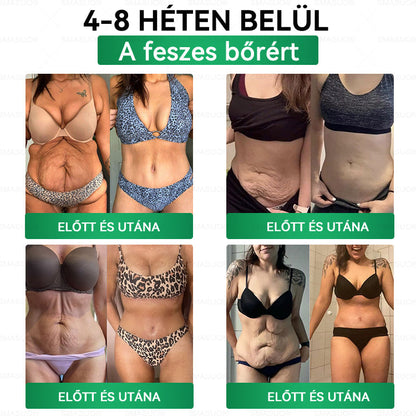 Európai egészségügyi előírásoknak megfelelő · 👩‍⚕️Orvosi szakértők által ajánlott termék| 🎁 SMASUO® Glumasetide 8 az 1-ben Karcsú és Egészséges Nano Mikrotűs Tapasz